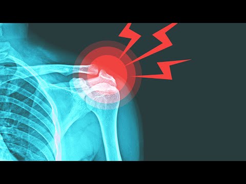 Video exercises for shoulder pain